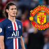Cavani:” M.U muốn thắng PSG hãy cứ để tôi vào sân’